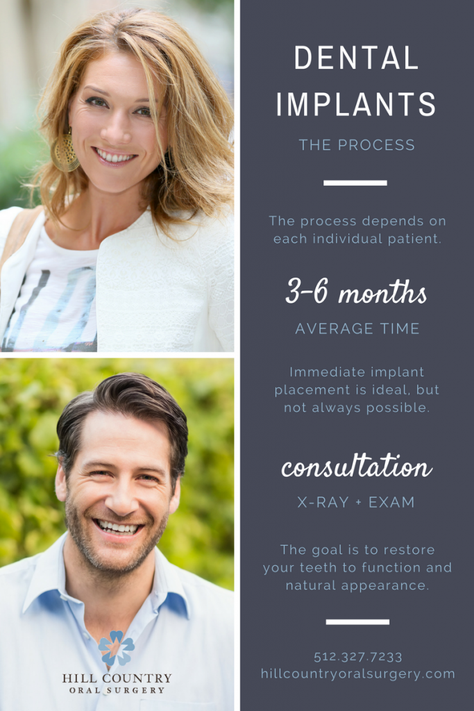 Dental Implant Process Infographic